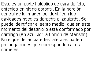 Cuadro de texto: Este es un corte holptico de cara de feto, obtenido en plano coronal. En la porcin central de la imagen se identifican las cavidades nasales derecha e izquierda. Se puede identificar el septo medio, que en este momento del desarrollo est conformado por cartlago (en azul por la tincin de Masson). Note que de las paredes laterales parten prolongaciones que corresponden a los cornetes.