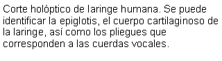 Cuadro de texto: Corte holptico de laringe humana. Se puede identificar la epiglotis, el cuerpo cartilaginoso de la laringe, as como los pliegues que corresponden a las cuerdas vocales.