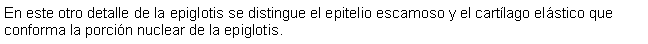 Cuadro de texto: En este otro detalle de la epiglotis se distingue el epitelio escamoso y el cartlago elstico que conforma la porcin nuclear de la epiglotis.