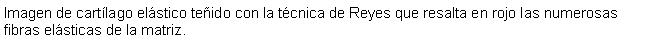 Cuadro de texto: Imagen de cartlago elstico teido con la tcnica de Reyes que resalta en rojo las numerosas fibras elsticas de la matriz.