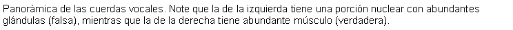 Cuadro de texto: Panormica de las cuerdas vocales. Note que la de la izquierda tiene una porcin nuclear con abundantes glndulas (falsa), mientras que la de la derecha tiene abundante msculo (verdadera).