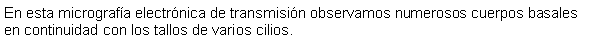 Cuadro de texto: En esta micrografa electrnica de transmisin observamos numerosos cuerpos basales en continuidad con los tallos de varios cilios.