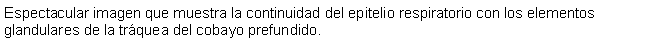 Cuadro de texto: Espectacular imagen que muestra la continuidad del epitelio respiratorio con los elementos glandulares de la trquea del cobayo prefundido.