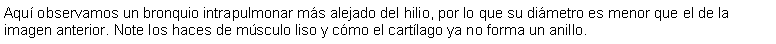 Cuadro de texto: Aqu observamos un bronquio intrapulmonar ms alejado del hilio, por lo que su dimetro es menor que el de la imagen anterior. Note los haces de msculo liso y cmo el cartlago ya no forma un anillo. 