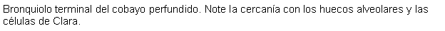 Cuadro de texto: Bronquiolo terminal del cobayo perfundido. Note la cercana con los huecos alveolares y las clulas de Clara.