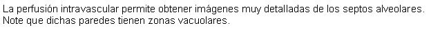 Cuadro de texto: La perfusin intravascular permite obtener imgenes muy detalladas de los septos alveolares. Note que dichas paredes tienen zonas vacuolares.
