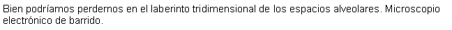Cuadro de texto: Bien podramos perdernos en el laberinto tridimensional de los espacios alveolares. Microscopio electrnico de barrido.