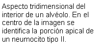 Cuadro de texto: Aspecto tridimensional del interior de un alvolo. En el centro de la imagen se identifica la porcin apical de un neumocito tipo II.