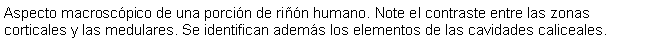 Cuadro de texto: Aspecto macroscpico de una porcin de rin humano. Note el contraste entre las zonas corticales y las medulares. Se identifican adems los elementos de las cavidades caliceales.