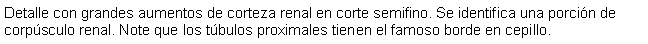 Cuadro de texto: Detalle con grandes aumentos de corteza renal en corte semifino. Se identifica una porcin de corpsculo renal. Note que los tbulos proximales tienen el famoso borde en cepillo.