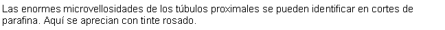 Cuadro de texto: Las enormes microvellosidades de los tbulos proximales se pueden identificar en cortes de parafina. Aqu se aprecian con tinte rosado. 