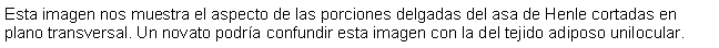 Cuadro de texto: Esta imagen nos muestra el aspecto de las porciones delgadas del asa de Henle cortadas en plano transversal. Un novato podra confundir esta imagen con la del tejido adiposo unilocular. 