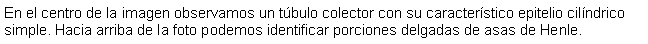 Cuadro de texto: En el centro de la imagen observamos un tbulo colector con su caracterstico epitelio cilndrico simple. Hacia arriba de la foto podemos identificar porciones delgadas de asas de Henle.