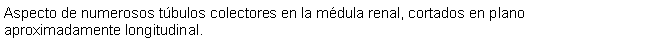 Cuadro de texto: Aspecto de numerosos tbulos colectores en la mdula renal, cortados en plano aproximadamente longitudinal.