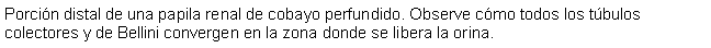 Cuadro de texto: Porcin distal de una papila renal de cobayo perfundido. Observe cmo todos los tbulos colectores y de Bellini convergen en la zona donde se libera la orina.