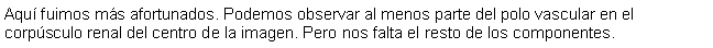 Cuadro de texto: Aqu fuimos ms afortunados. Podemos observar al menos parte del polo vascular en el corpsculo renal del centro de la imagen. Pero nos falta el resto de los componentes.