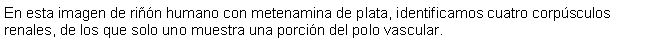 Cuadro de texto: En esta imagen de rin humano con metenamina de plata, identificamos cuatro corpsculos renales, de los que solo uno muestra una porcin del polo vascular.