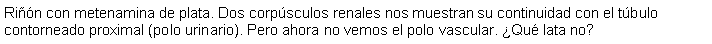 Cuadro de texto: Rin con metenamina de plata. Dos corpsculos renales nos muestran su continuidad con el tbulo contorneado proximal (polo urinario). Pero ahora no vemos el polo vascular. Qu lata no?