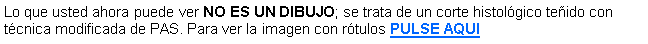 Cuadro de texto: Lo que usted ahora puede ver no es un dibujo; se trata de un corte histolgico teido con tcnica modificada de PAS. Para ver la imagen con rtulos PULSE AQUI