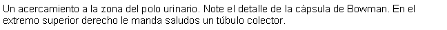 Cuadro de texto: Un acercamiento a la zona del polo urinario. Note el detalle de la cpsula de Bowman. En el extremo superior derecho le manda saludos un tbulo colector.