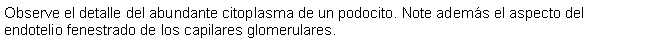 Cuadro de texto: Observe el detalle del abundante citoplasma de un podocito. Note adems el aspecto del endotelio fenestrado de los capilares glomerulares.