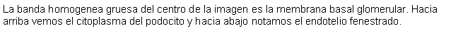 Cuadro de texto: La banda homogenea gruesa del centro de la imagen es la membrana basal glomerular. Hacia arriba vemos el citoplasma del podocito y hacia abajo notamos el endotelio fenestrado.