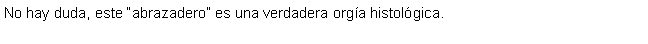 Cuadro de texto: No hay duda, este abrazadero es una verdadera orga histolgica.