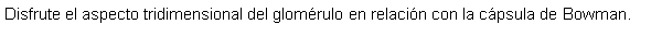 Cuadro de texto: Disfrute el aspecto tridimensional del glomrulo en relacin con la cpsula de Bowman.