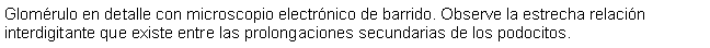 Cuadro de texto: Glomrulo en detalle con microscopio electrnico de barrido. Observe la estrecha relacin interdigitante que existe entre las prolongaciones secundarias de los podocitos.