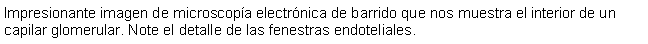 Cuadro de texto: Impresionante imagen de microscopa electrnica de barrido que nos muestra el interior de un capilar glomerular. Note el detalle de las fenestras endoteliales.