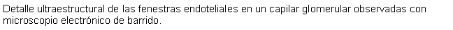 Cuadro de texto: Detalle ultraestructural de las fenestras endoteliales en un capilar glomerular observadas con microscopio electrnico de barrido.