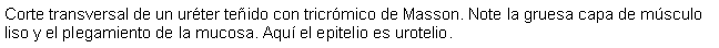 Cuadro de texto: Corte transversal de un urter teido con tricrmico de Masson. Note la gruesa capa de msculo liso y el plegamiento de la mucosa. Aqu el epitelio es urotelio.