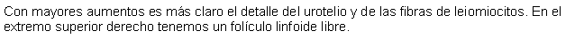 Cuadro de texto: Con mayores aumentos es ms claro el detalle del urotelio y de las fibras de leiomiocitos. En el extremo superior derecho tenemos un folculo linfoide libre.