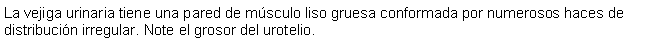 Cuadro de texto: La vejiga urinaria tiene una pared de msculo liso gruesa conformada por numerosos haces de distribucin irregular. Note el grosor del urotelio.