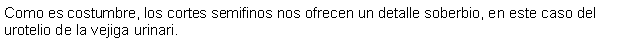 Cuadro de texto: Como es costumbre, los cortes semifinos nos ofrecen un detalle soberbio, en este caso del urotelio de la vejiga urinari.