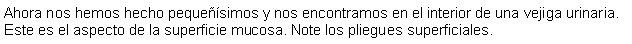 Cuadro de texto: Ahora nos hemos hecho pequesimos y nos encontramos en el interior de una vejiga urinaria. Este es el aspecto de la superficie mucosa. Note los pliegues superficiales.